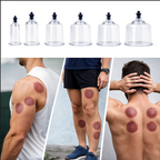 Coffret de Ventouses / Hijama