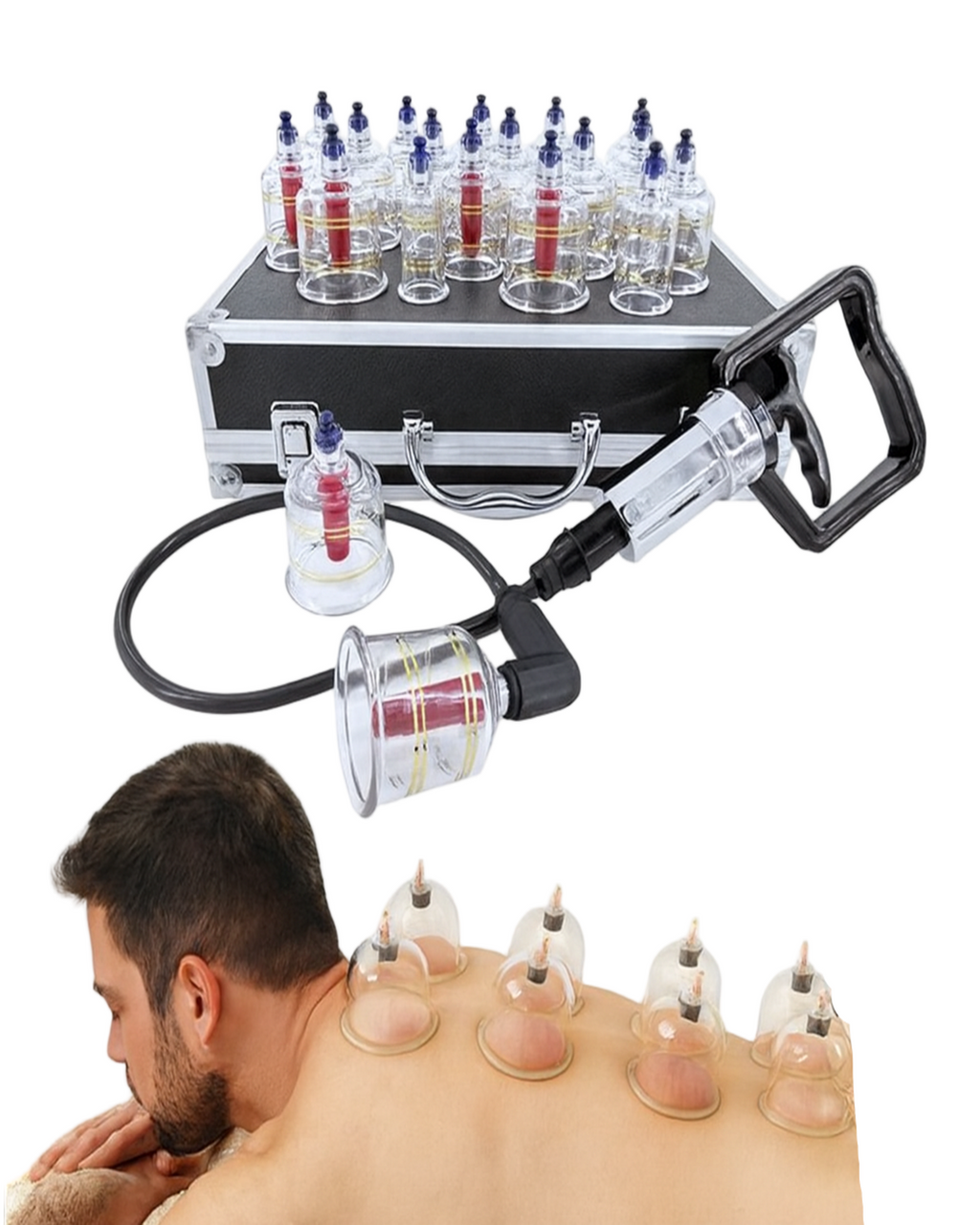 Kit de ventouses manuelles sous vide  (set)